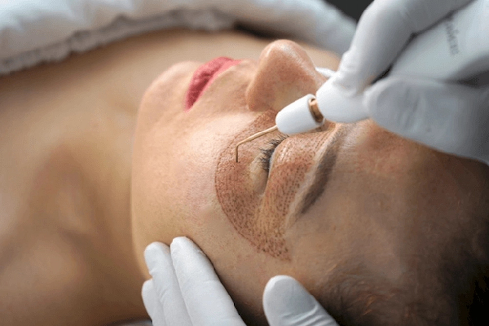 بهترین کلینیک زیبایی در شرق تهران در درمان پوست با پلاسماجت